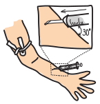 drawing of a needle with the bevel pointing up